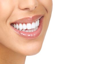 A woman after teeth whitening showing her beautiful teeth in a smile.