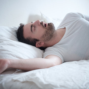 a man sleeping with an open mouth and snoring due to sleep apnea