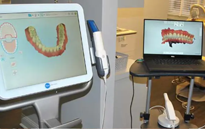 Dental office equipped with iTtero system