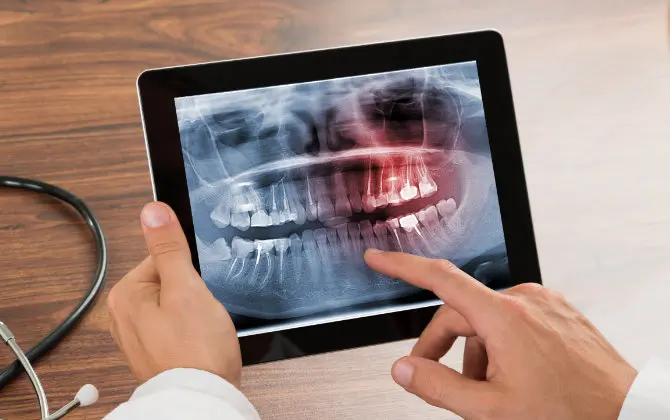 Dentist reviewing digital dental X-rays on a tablet