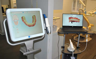Digital images of dental implants displayed on computer screens