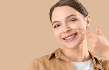 A close-up of a smiling young woman pointing her finger at her metal dental braces against a beige background.